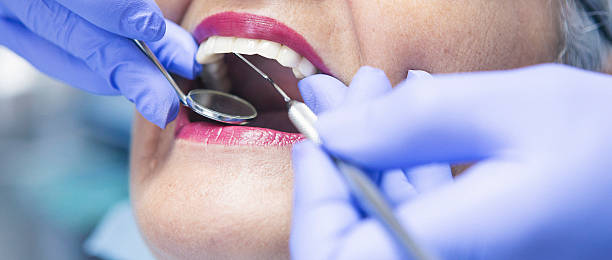 Best Dental Abscess Treatment in Cleveland Heights, OH